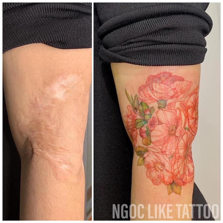 Scar Cover Up Tattoos by Ngoc Like Tattoo