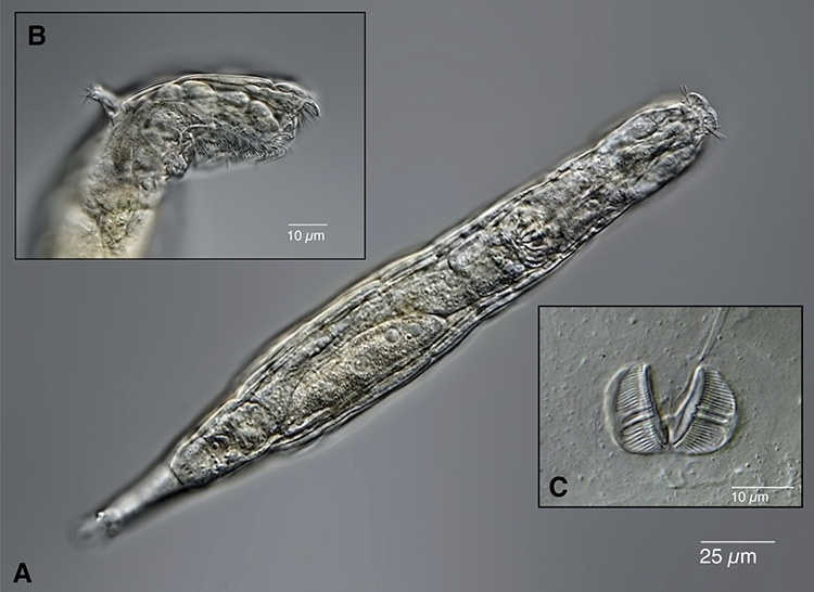 24,000 Year Old Rotifer Microorganism From the Siberian Permafrost Reawakens