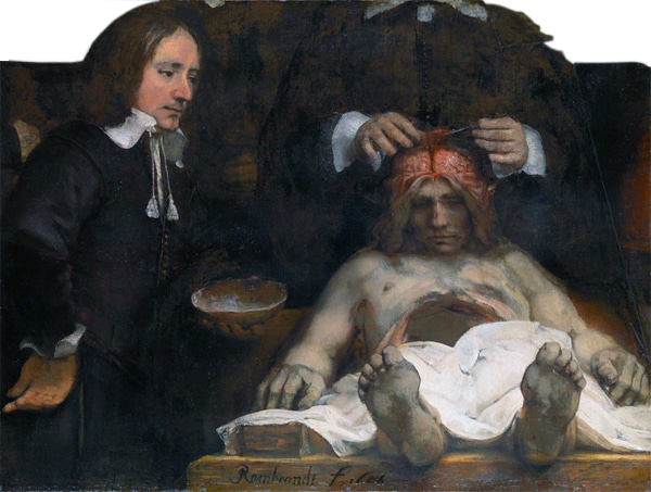 Anatomy Lesson by Rembrandt