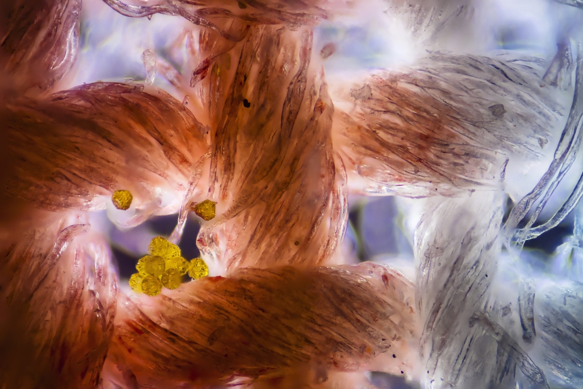 Photomicrography of Cotton Fabric with Pollen Grains