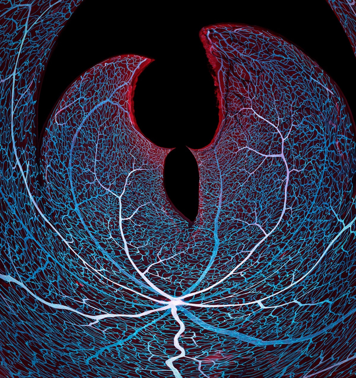 Vasculature of a Mouse Retina