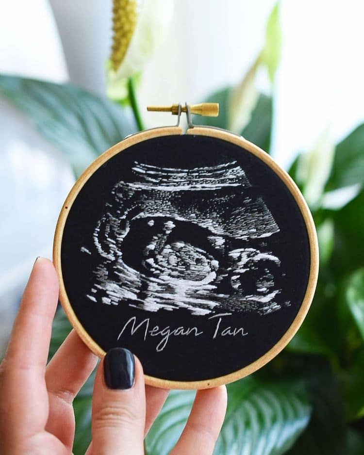 Ultrasound Embroidery by Yulia Sherbak