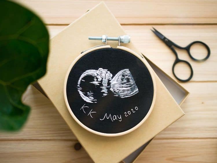 Ultrasound Embroidery by Yulia Sherbak