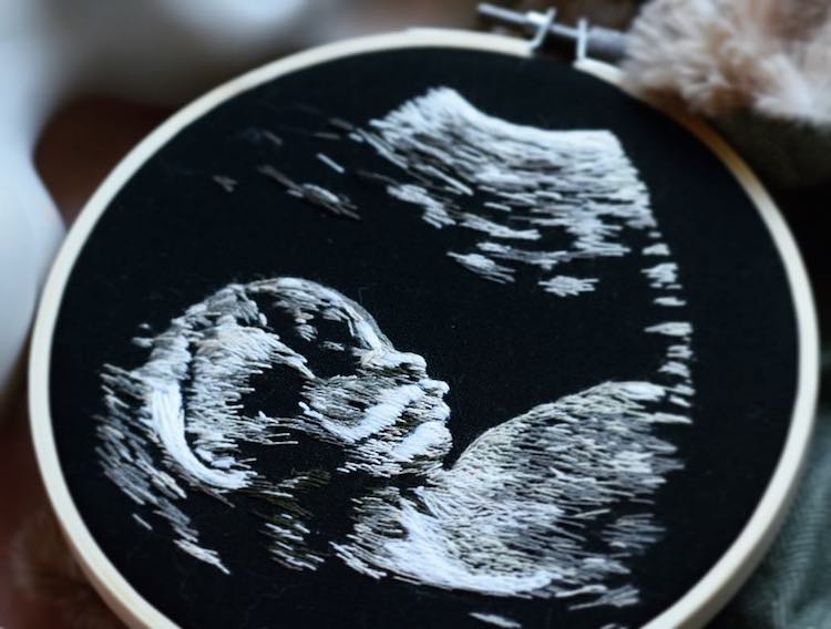 Ultrasound Embroidery by Yulia Sherbak