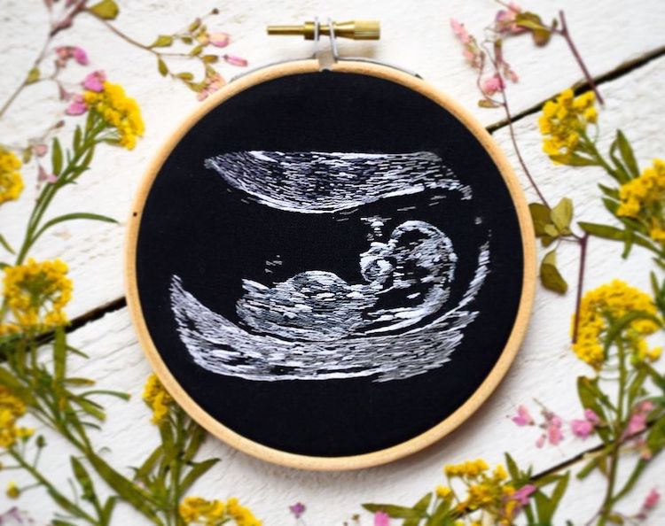 Ultrasound Embroidery by Yulia Sherbak
