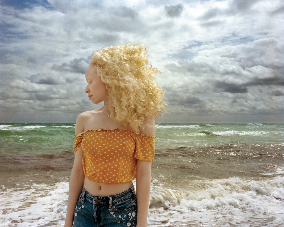 Blond Albino Woman on the Beach