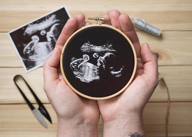 Ultrasound Embroidery by Yulia Sherbak