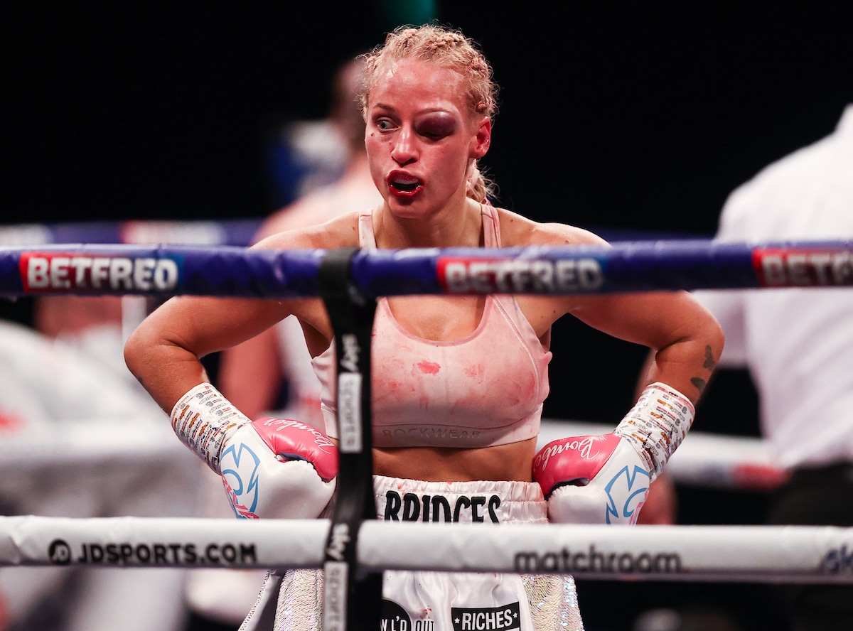 Female Boxer in the Ring with an Eye Injury