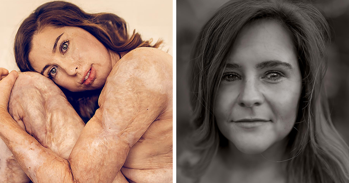 10 Captivating Portraits Of People Who Defy Society’s Expectations, As Captured By Sujata Setia