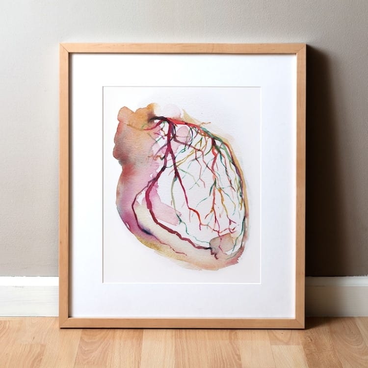 Coronary Angiogram Watercolor Print