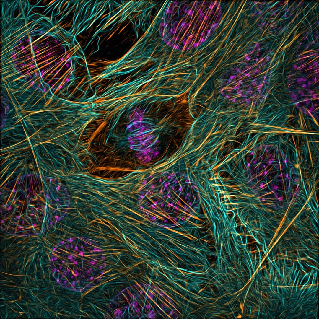 Cytoskeleton of a dividing myoblast