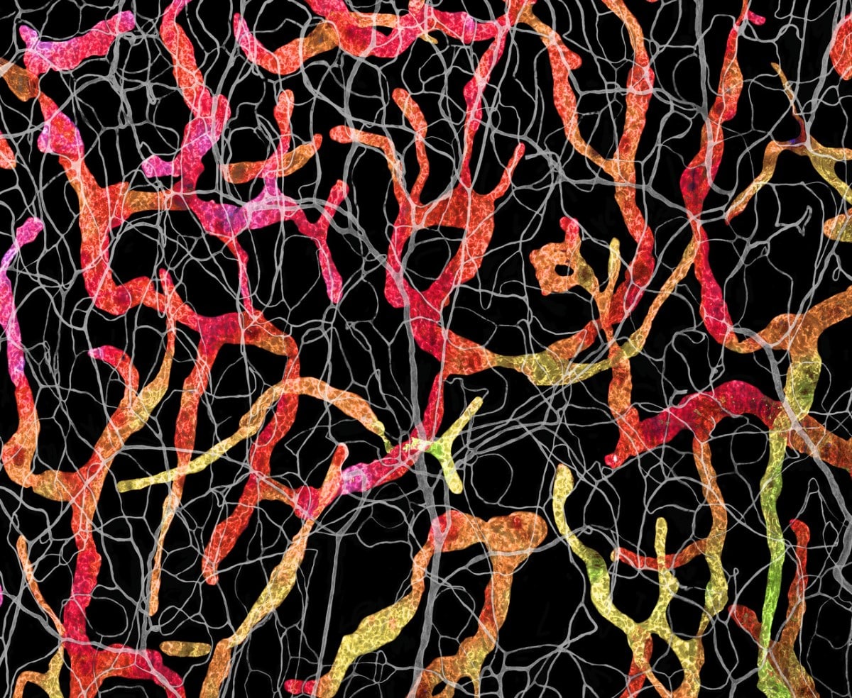 Photomicrography of a Blood and lymphatic vasculatures in the ear skin of an adult mouse