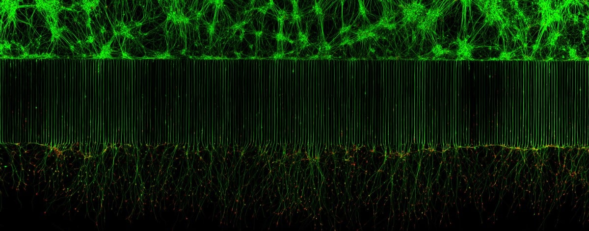 Motor neurons grown in microfluidic device for separation of cell bodies (top) and axons (bottom)